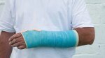 man-in-arm-cast---preventing-injury-157506178.jpg